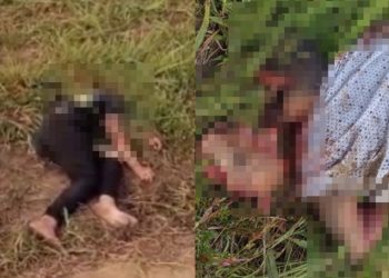 Homem tem o rosto arrancado após bater motocicleta em traseira de caminhão