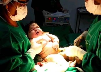 Nasce ‘super bebê’ com mais de sete quilos no interior do AM