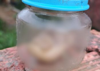 VÍDEO: dedo humano é encontrado em lixeira na Compensa
