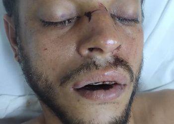 SES-AM pede ajuda para encontrar familiares de paciente internado no HPS João Lúcio