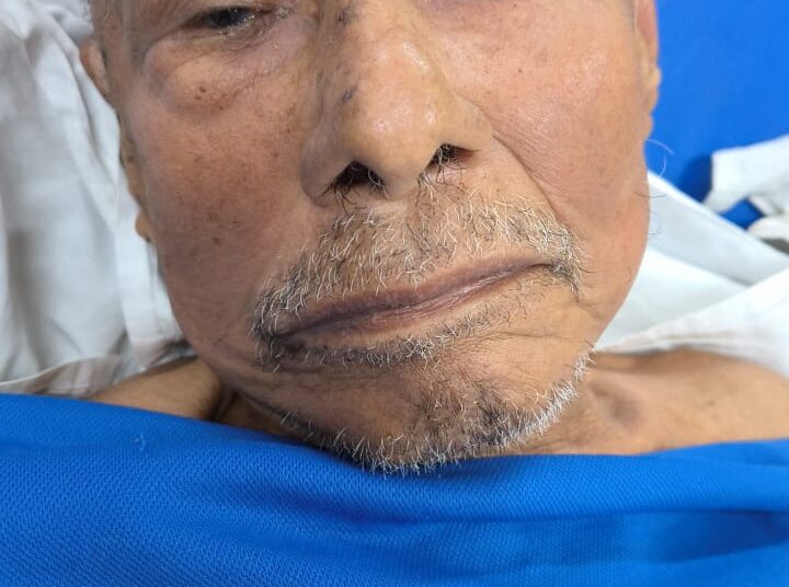 HPS João Lúcio pede ajuda para localizar familiares do paciente Fábio Pinheiro, de 75 anos